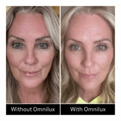 Omnilux Contour Face + Free $50 Planet Beauty E-Gift Card -Bumble Sale Store Omnilux Contour Face 4