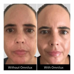 Omnilux Contour Face + Free $50 Planet Beauty E-Gift Card -Bumble Sale Store Omnilux Contour Face 5