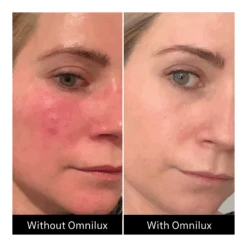 Omnilux Contour Face + Free $50 Planet Beauty E-Gift Card -Bumble Sale Store Omnilux Contour Face 7