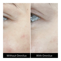 Omnilux Contour Face + Free $50 Planet Beauty E-Gift Card -Bumble Sale Store Omnilux Contour Face 8