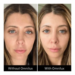 Omnilux Contour Face + Free $50 Planet Beauty E-Gift Card -Bumble Sale Store Omnilux Contour Face 9