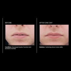 PCA SKIN Hydrating Serum 7 PCA SKIN Hydrating Serum -Bumble Sale Store PCA Skin Hydrating Serum 1