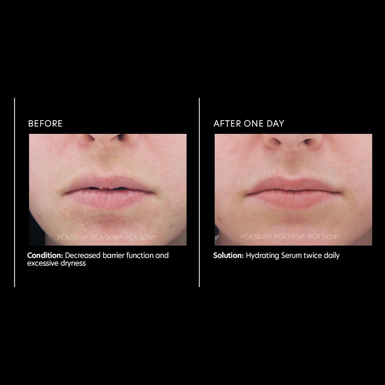 PCA SKIN Hydrating Serum 5 PCA SKIN Hydrating Serum - Image 3