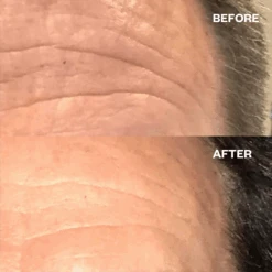 Wrinkles Schminkles Forehead Wrinkle Patches - 2pk -Bumble Sale Store Wrinkles Schminkles Forehead Wrinkle Patch 1