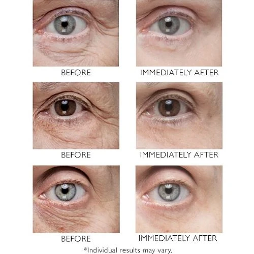 Peter Thomas Roth Instant FirmX Eye 8 Peter Thomas Roth Instant FirmX Eye - Image 6