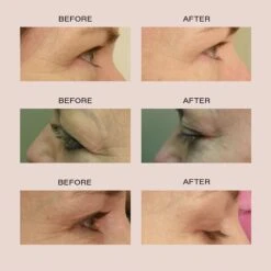 Vanity Planet Alya Red LED Eye Glasses - Grey 7 Vanity Planet Alya Red LED Eye Glasses - Grey -Bumble Sale Store vanity planet alya red LED eye glasses beforeafter 04ea27e3 5214 4a3c aea5 ed2b8a7907c2